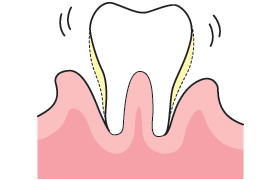 ���j�������Ƌۂ̊֌W�Q